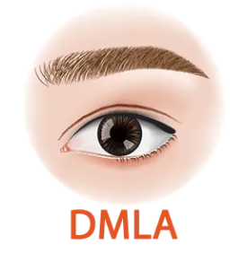 Cataracte - Avant/Après